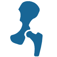 trauma plate
